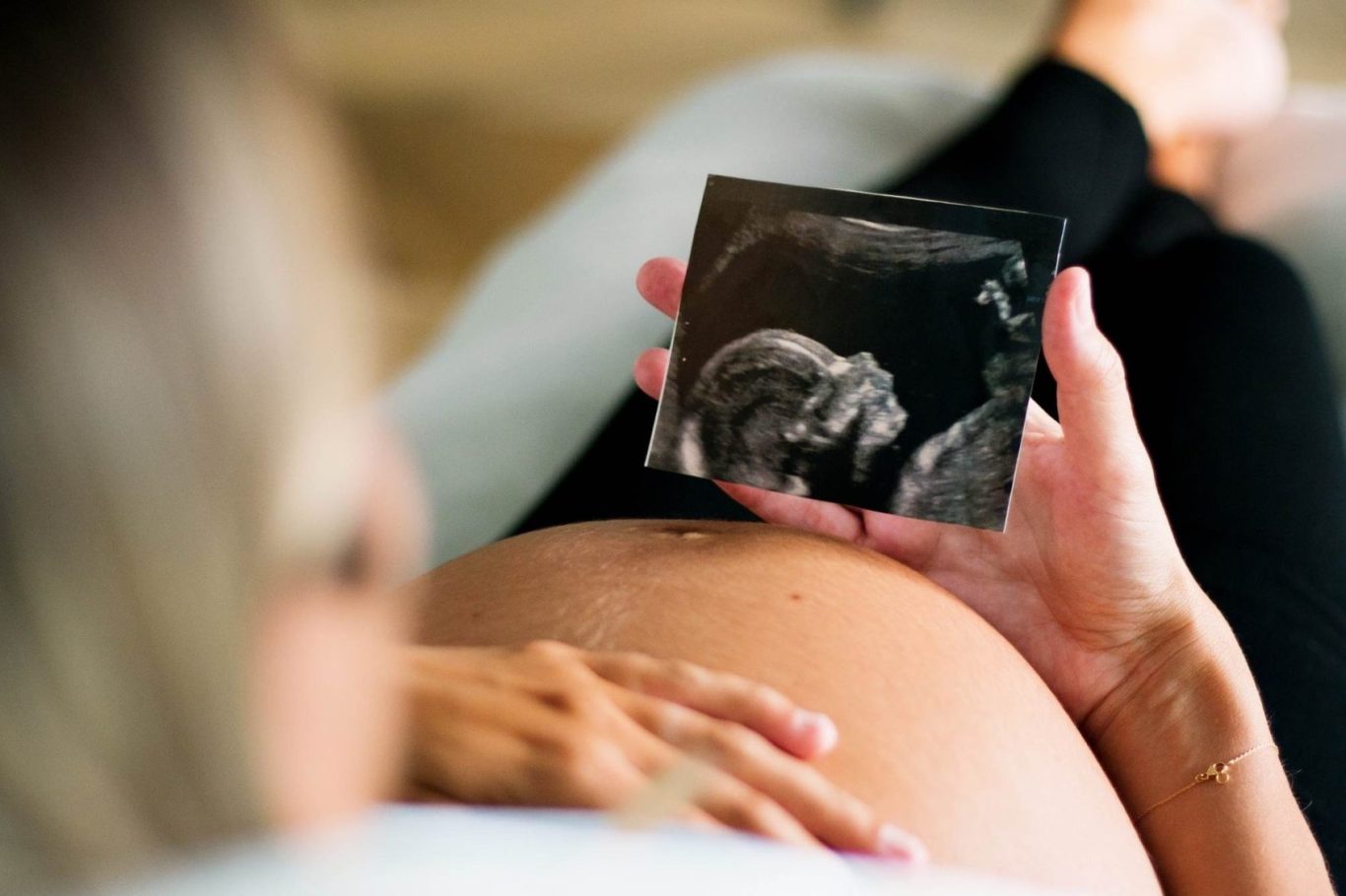 Schwangere hält ein Ultraschallbild ihres ungeborenen Kindes auf dem Bauch.